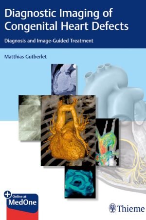 Diagnostic Imaging of Congenital Heart Defects