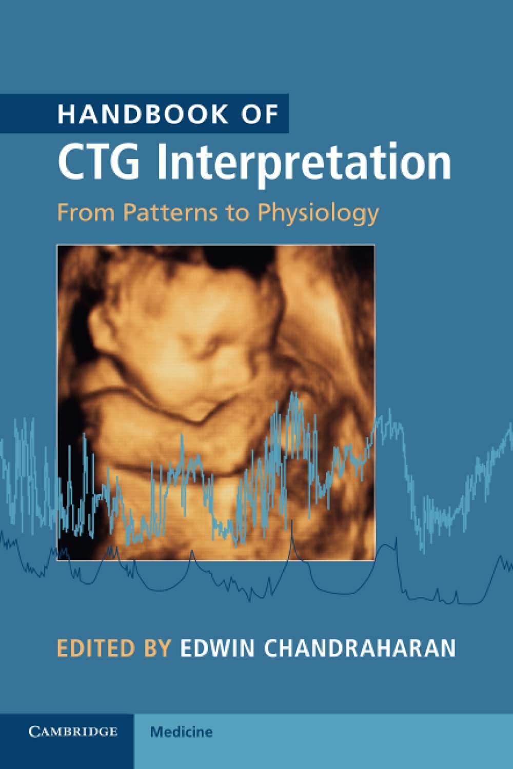 Handbook of CTG Interpretation PDF