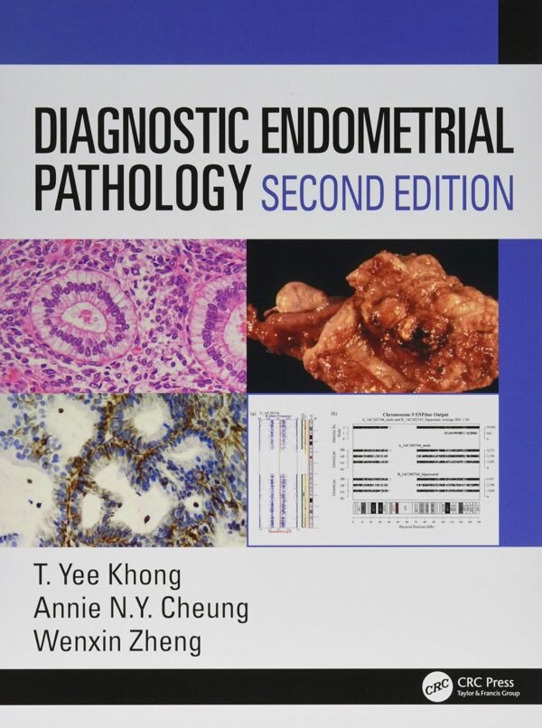 Diagnostic Endometrial Pathology 2nd Edition PDF