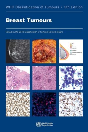 Breast Tumours: WHO Classification of Tumours 5th Edition PDF
