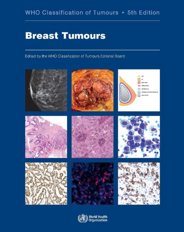 Breast Tumours: WHO Classification of Tumours 5th Edition PDF