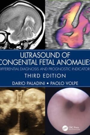 Ultrasound of Congenital Fetal Anomalies 3rd Edition PDF