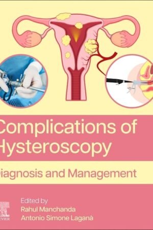 Complications of Hysteroscopy PDF