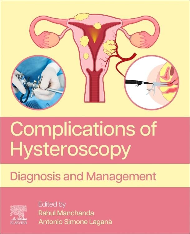 Complications of Hysteroscopy PDF