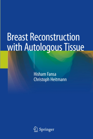 Breast Reconstruction with Autologous Tissue PDF