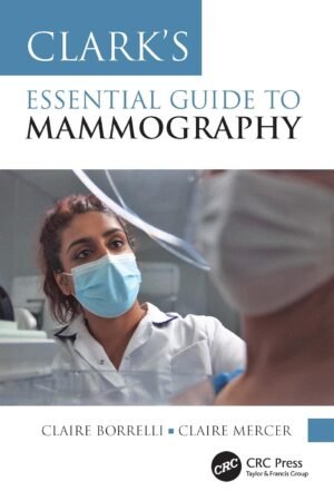 Clark's Essential Guide to Mammography PDF