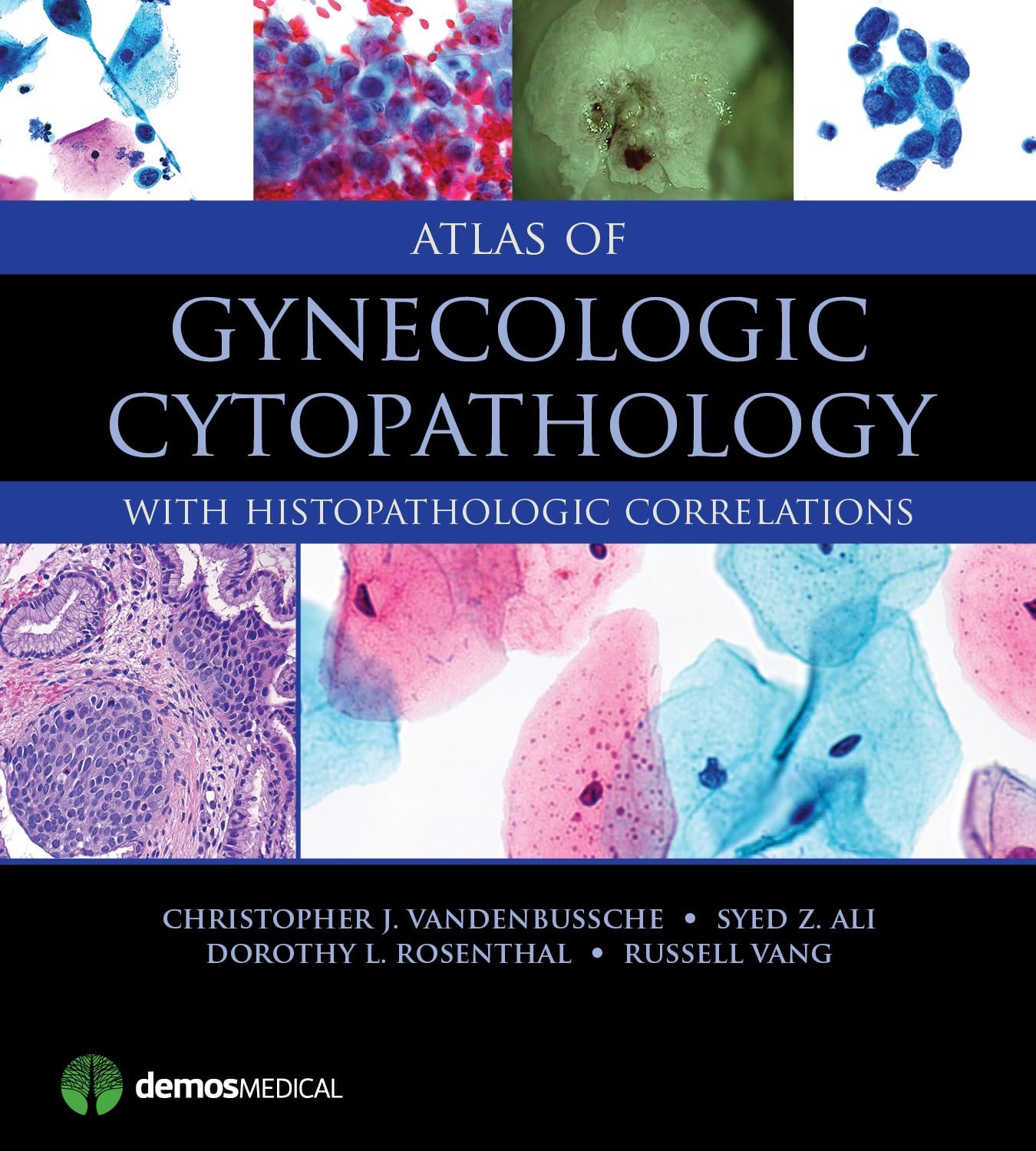 Atlas of Gynecologic Cytopathology PDF