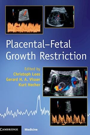 Placental-Fetal Growth Restriction PDF