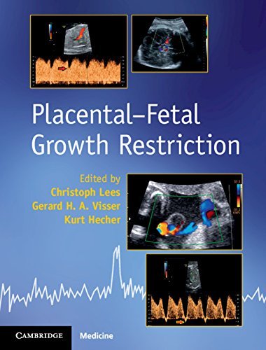 Placental-Fetal Growth Restriction PDF