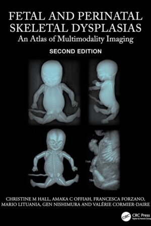 Fetal and Perinatal Skeletal Dysplasias 2nd Edition PDF