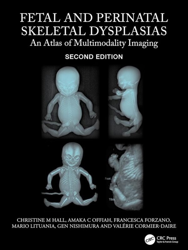Fetal and Perinatal Skeletal Dysplasias 2nd Edition PDF