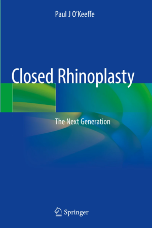 Closed Rhinoplasty: The Next Generation PDF