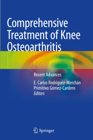 Comprehensive Treatment of Knee Osteoarthritis PDF