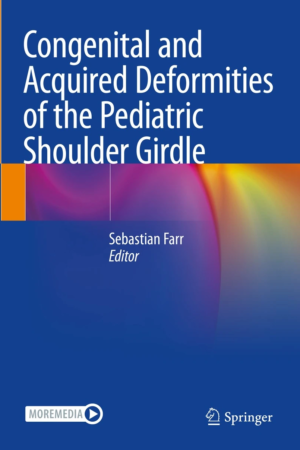 Congenital and Acquired Deformities of the Pediatric Shoulder Girdle PDF