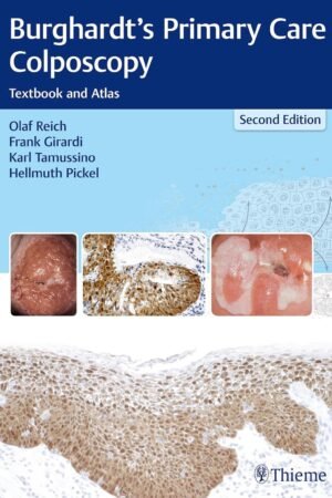 Burghardt's Primary Care Colposcopy 2nd Edition PDF