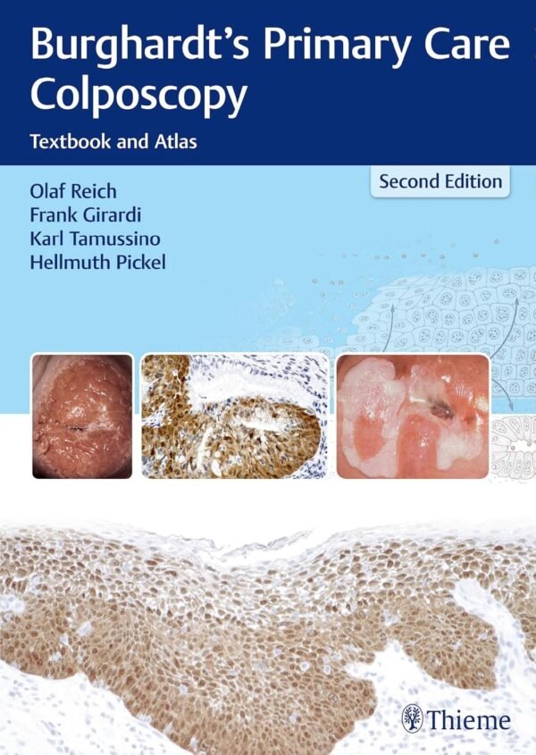 Burghardt's Primary Care Colposcopy 2nd Edition PDF