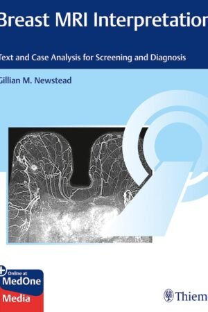 Breast MRI Interpretation PDF