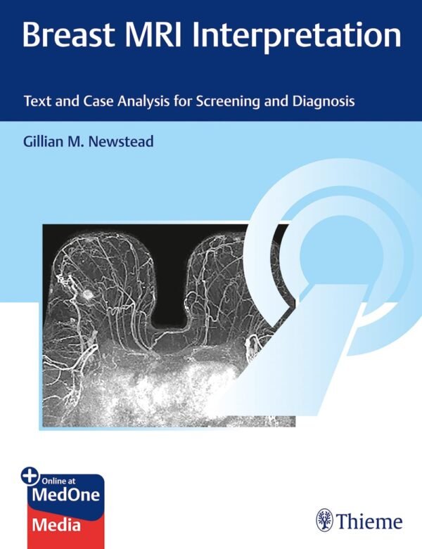 Breast MRI Interpretation PDF