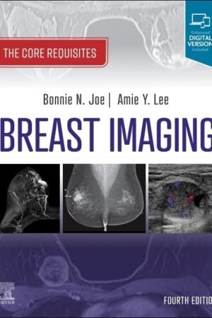 Breast Imaging 4th Edition PDF
