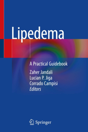 Lipedema PDF