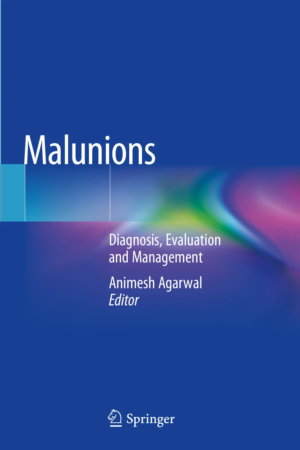Malunions PDF