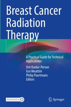 Breast Cancer Radiation Therapy PDF