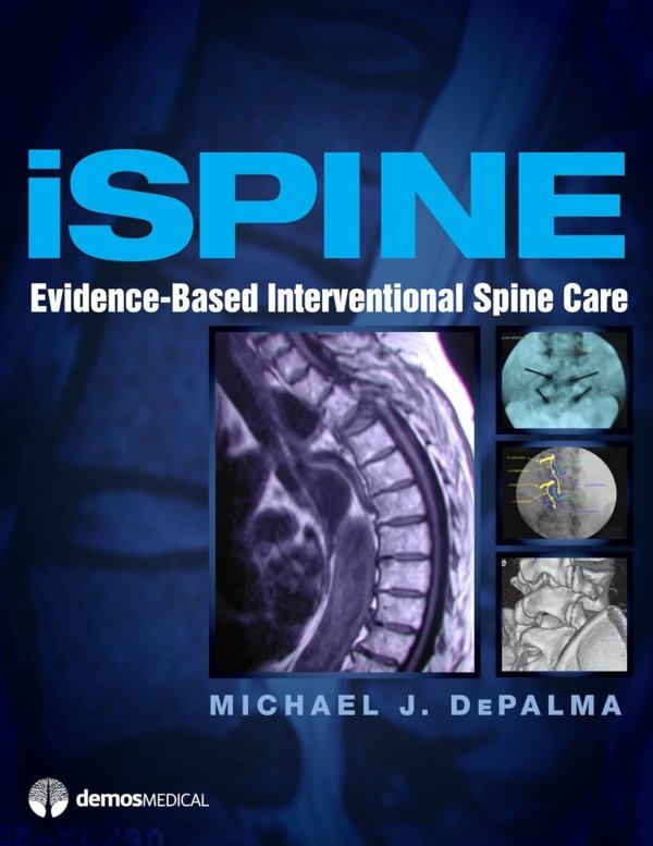 iSpine: Evidence-Based Interventional Spine Care PDF
