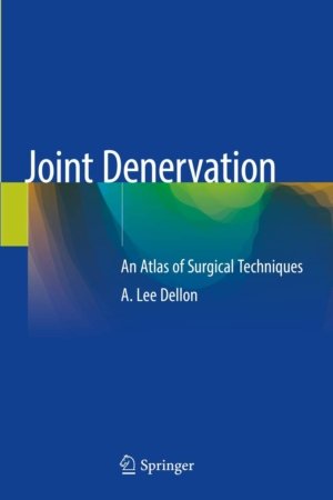Joint Denervation: An Atlas of Surgical Techniques PDF