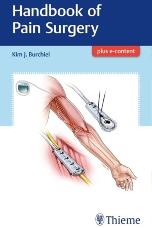 Handbook of Pain Surgery PDF