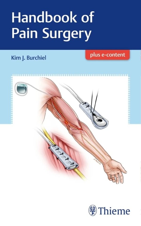 Handbook of Pain Surgery PDF