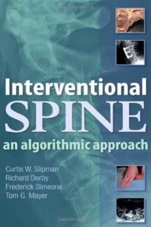 Interventional Spine: An Algorithmic Approach PDF