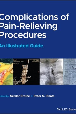 Complications of Pain-Relieving Procedures PDF