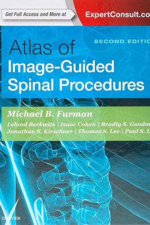 Atlas of Image Guided Spinal Procedures 2nd Edition PDF