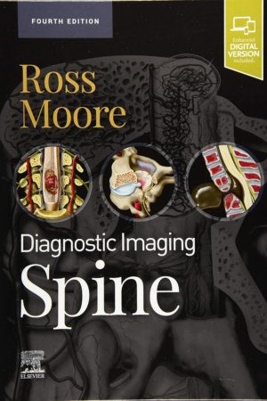 Diagnostic Imaging: Spine 4th Edition PDF