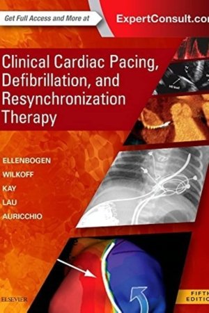 Clinical Cardiac Pacing Defibrillation and Resynchronization Therapy 5E PDF