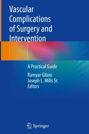 Vascular Complications of Surgery and Intervention PDF