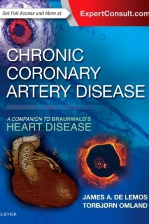 Chronic Coronary Artery Disease: A Companion to Braunwald's Heart Disease PDF