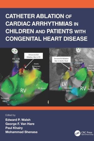 Catheter Ablation of Cardiac Arrhythmias in Children and Patients with Congenital Heart Disease PDF