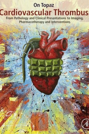 Cardiovascular Thrombus PDF