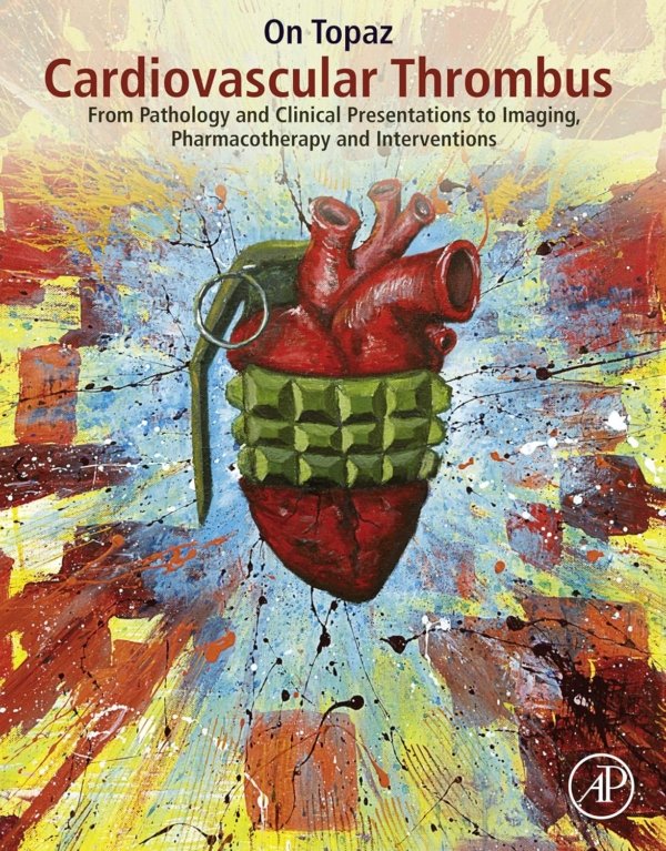 Cardiovascular Thrombus PDF