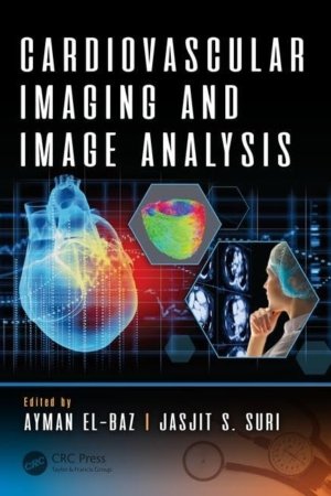 Cardiovascular Imaging and Image Analysis PDF