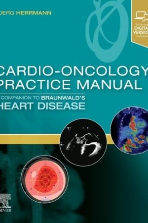 Cardio-Oncology Practice Manual: A Companion to Braunwald’s Heart Disease PDF
