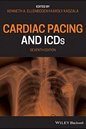 Cardiac Pacing and ICDs 7E PDF
