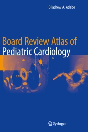 Board Review Atlas of Pediatric Cardiology PDF