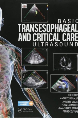 Basic Transesophageal and Critical Care Ultrasound PDF
