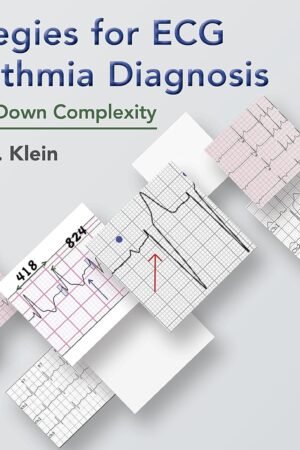 Strategies for ECG Arrhythmia Diagnosis