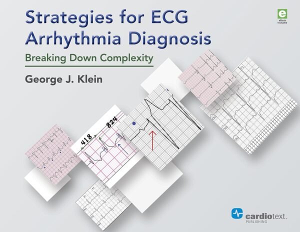 Strategies for ECG Arrhythmia Diagnosis