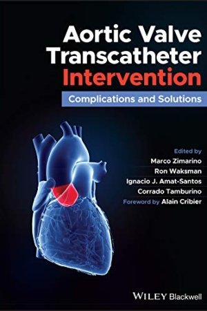 Aortic Valve Transcatheter Intervention PDF
