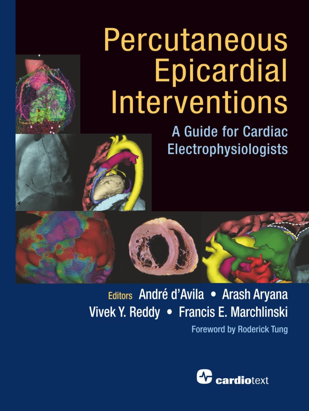 Percutaneous Epicardial Interventions PDF