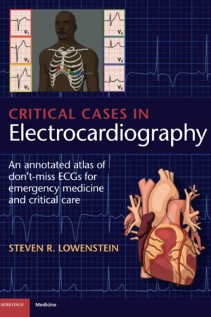 Critical Cases in Electrocardiography
